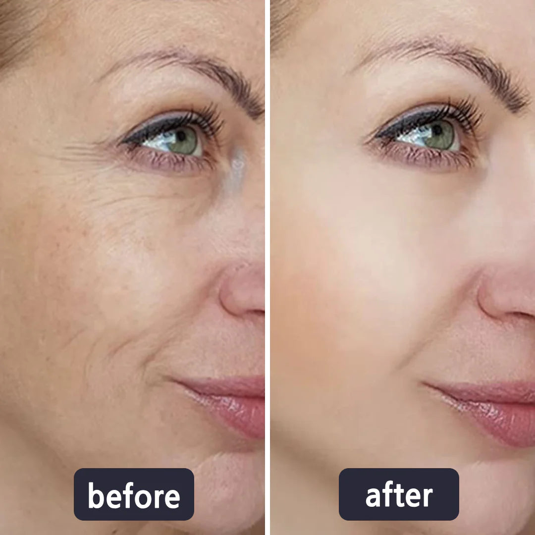 4-in-1 skincare wand