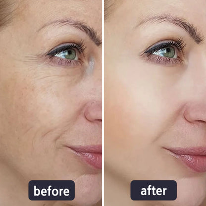 4-in-1 Skincare Wand